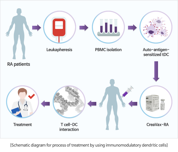 면역조절 수지상세포 이용 치료과정 모식도